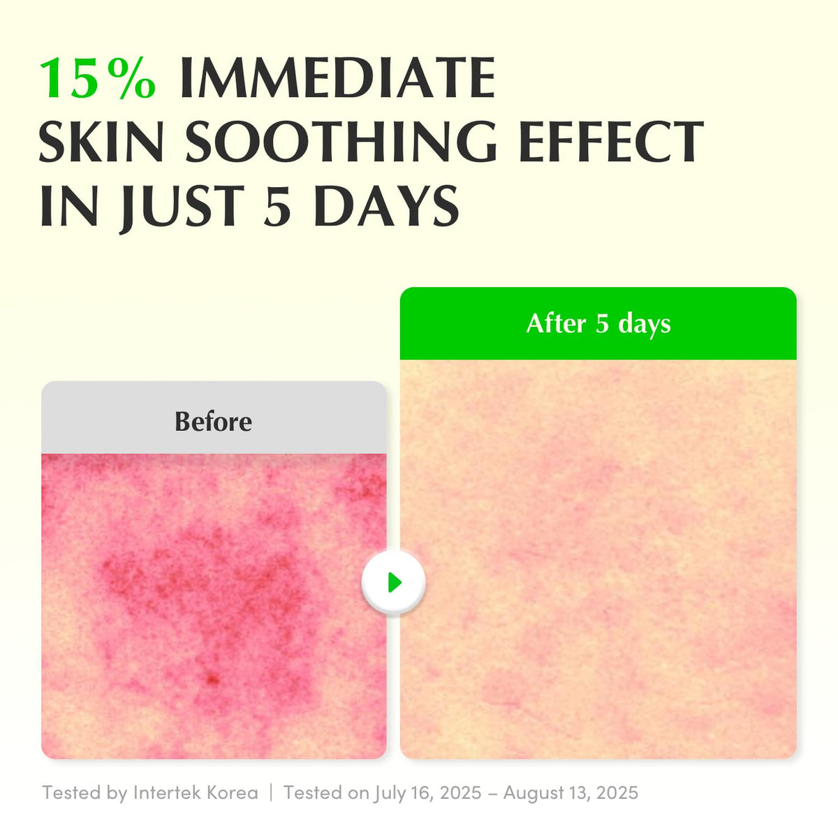 EQQUALBERRY Aloe PDRN Calming Serum