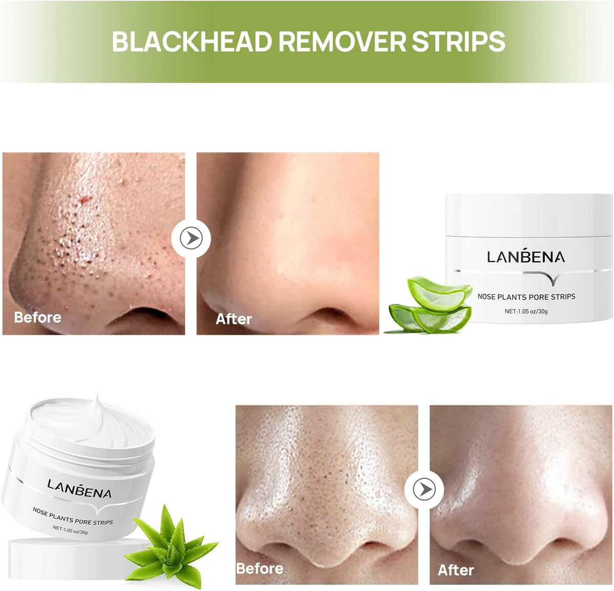 Lanbena Nose Pore Plants Strips