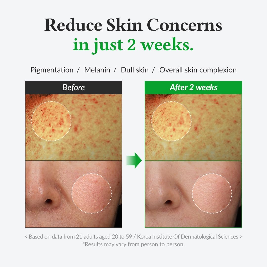 Dr. Althea Gentle Vitamin C Serum 20%