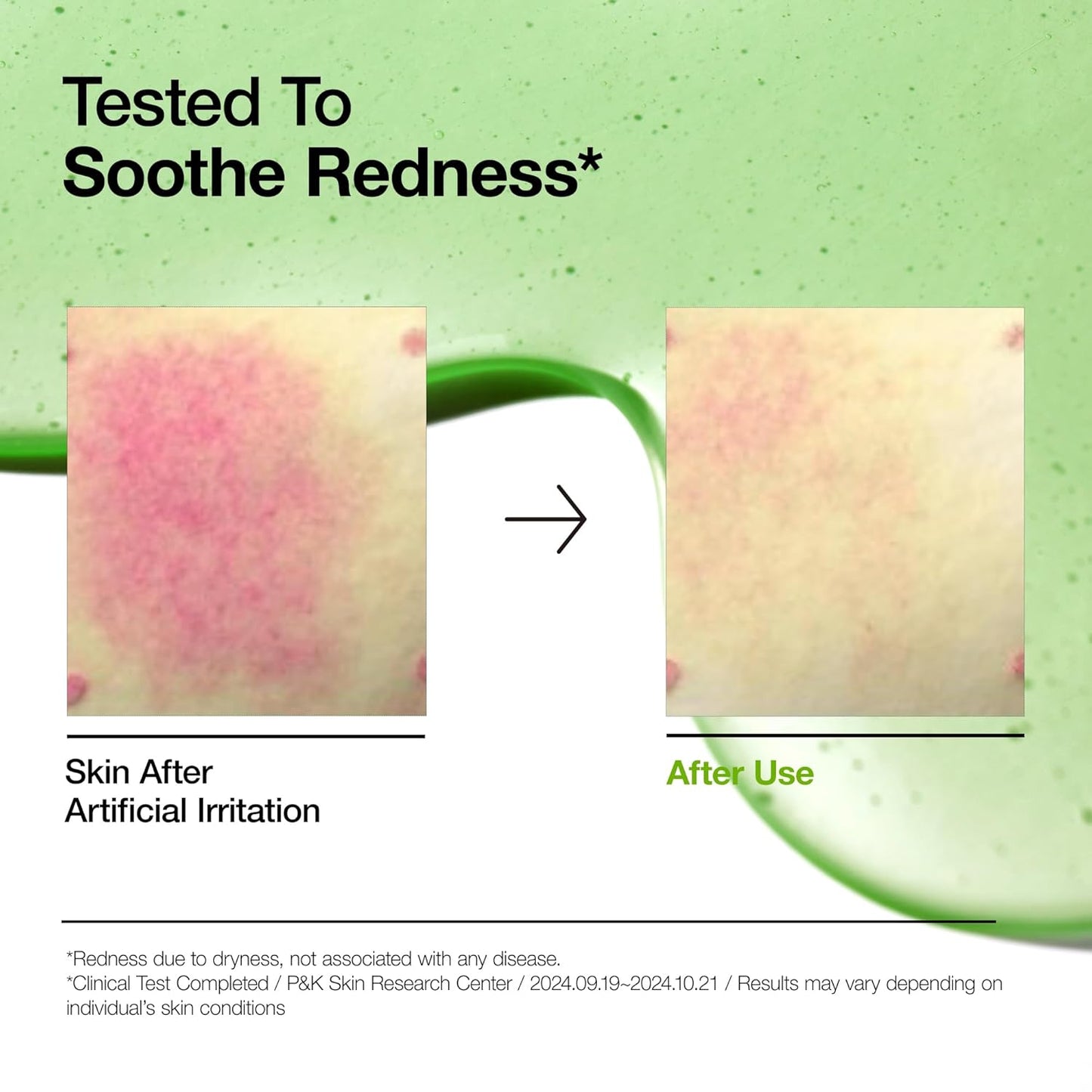 Anua Azelaic Acid 10+ Hyaluron Redness Soothing Serum