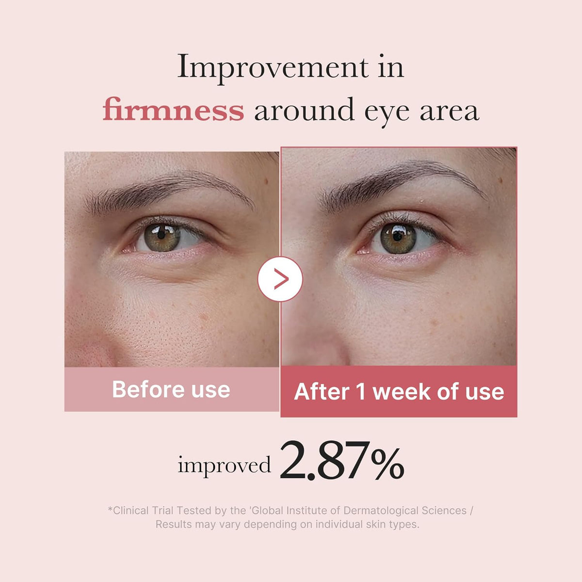 Medicube PDRN Pink Peptide Eye Cream
