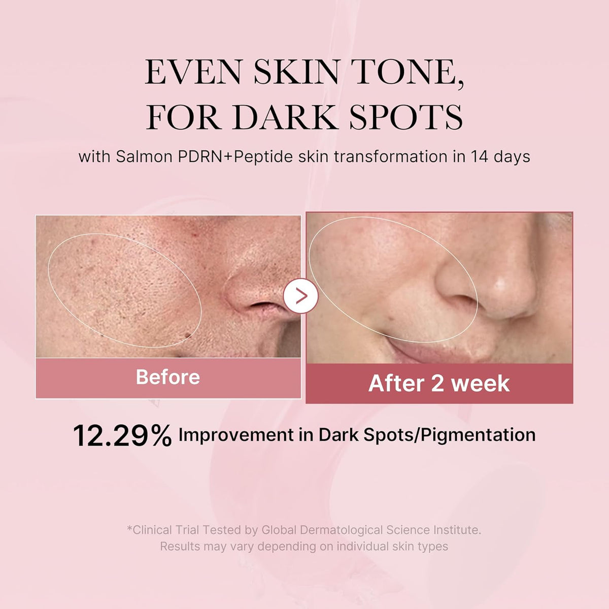 Medicube Salmon DNA PDRN Pink CICA Soothing Toner – Calm, Repair & Glow