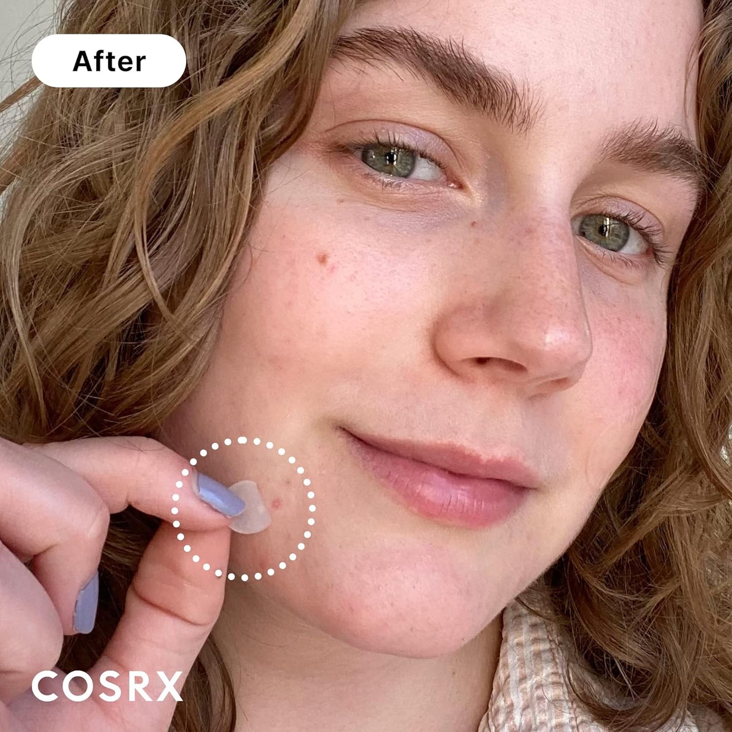 COSRX Acne Pimple Master Patch – Heal, Protect & Clear Overnight