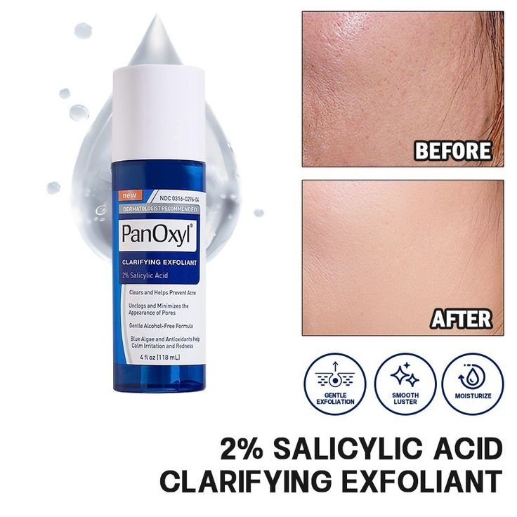 PanOxyl Clarifying Exfoliant – 2% Salicylic Acid