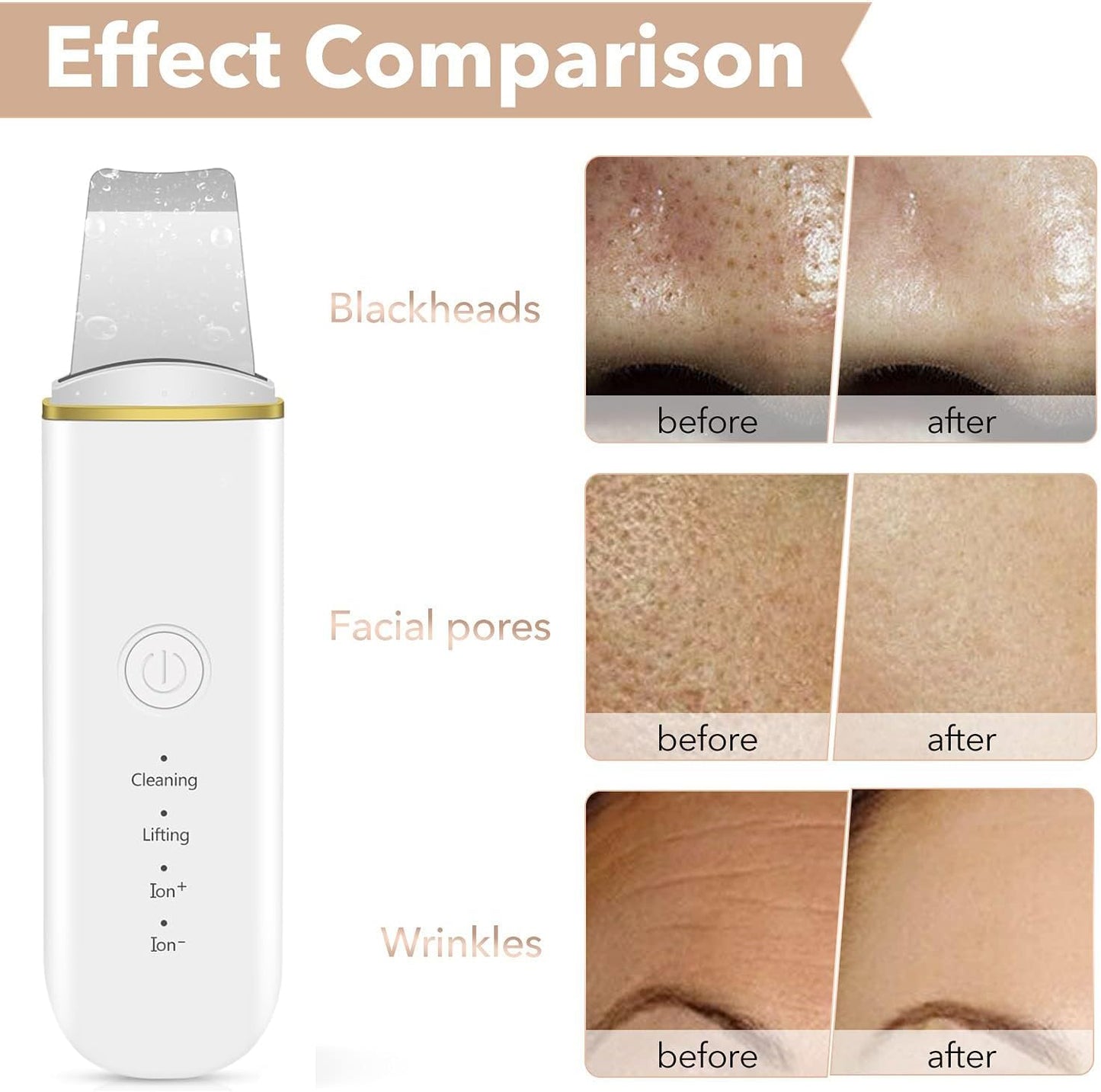 Ultrasonic Skin Scrubber & Face Lifting Device