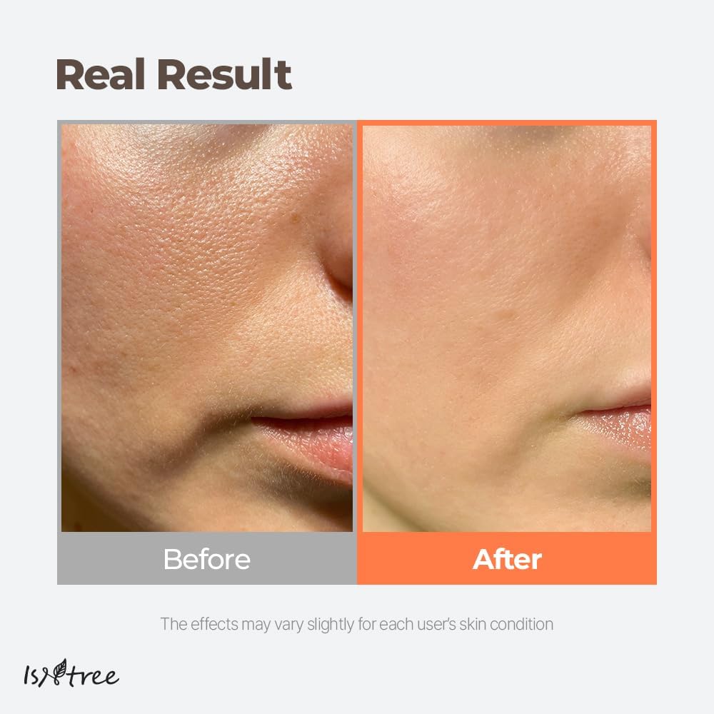 ISNTREE Green Tea Fresh Toner – Calm, Balance & Refresh