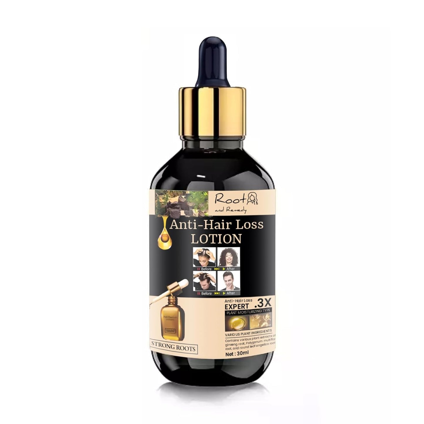 Anti-Hair Loss Lotion – Strong Roots Formula