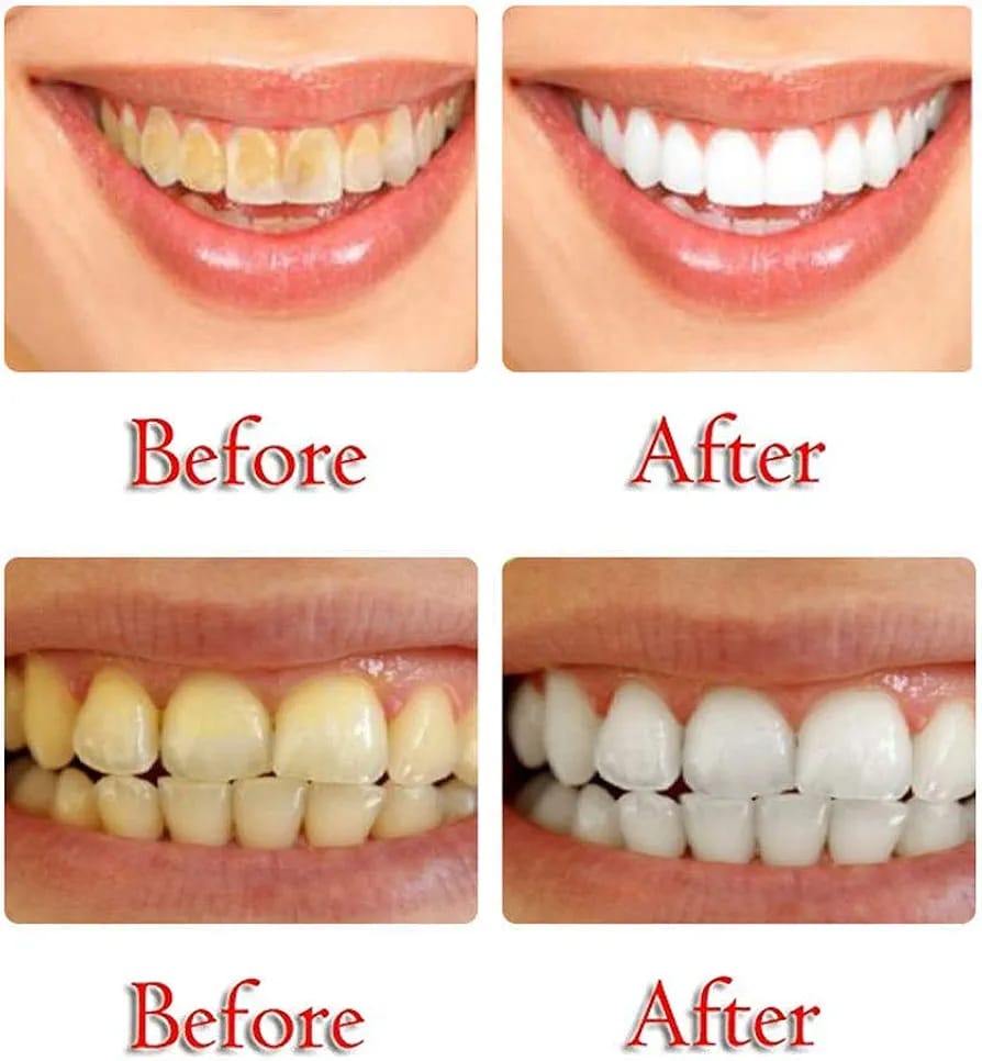 Foaming Baking Soda Toothpaste 🦷 (Fruit Flavors)