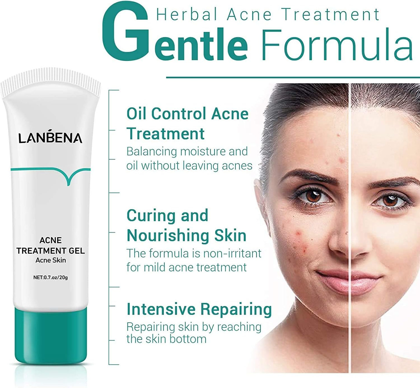 Lanbena Acne Treatment Gel – Clear, Calm & Restore