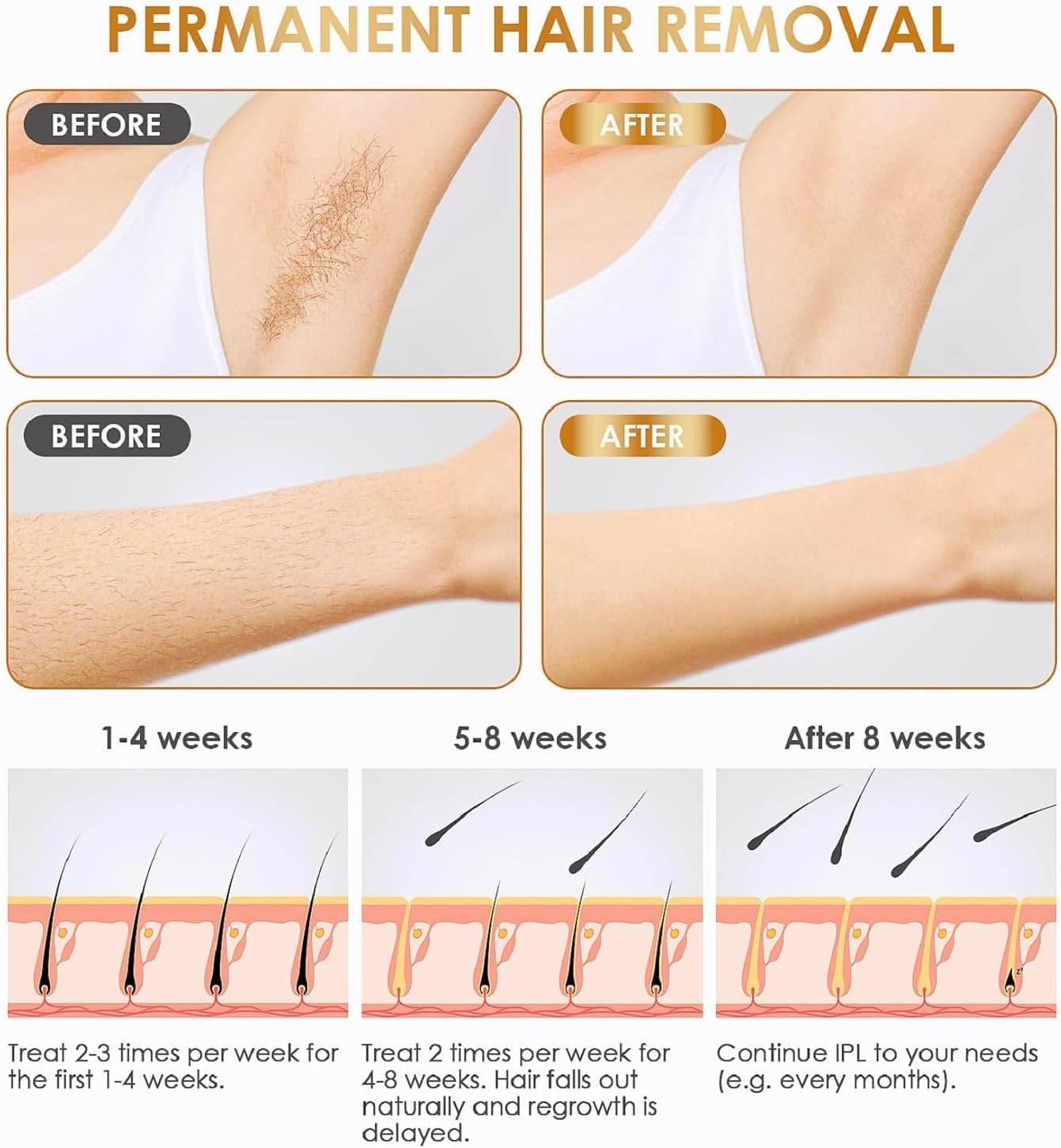 IPL Laser Hair Removal Device