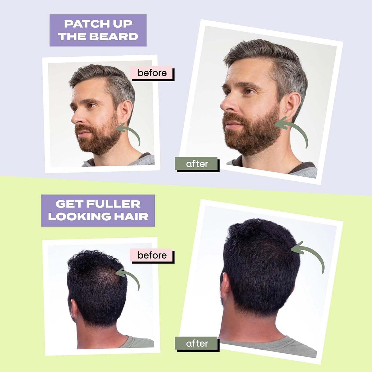 Toppik Hair Perfecting Tool Kit