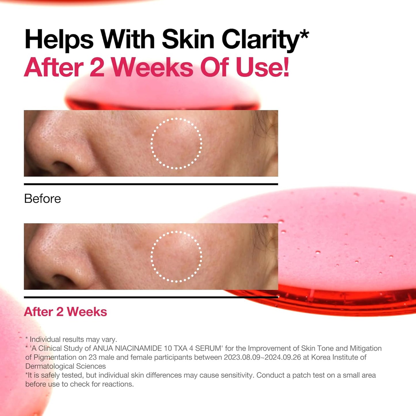 ANUA Niacinamide 10% + TXA 4% Serum