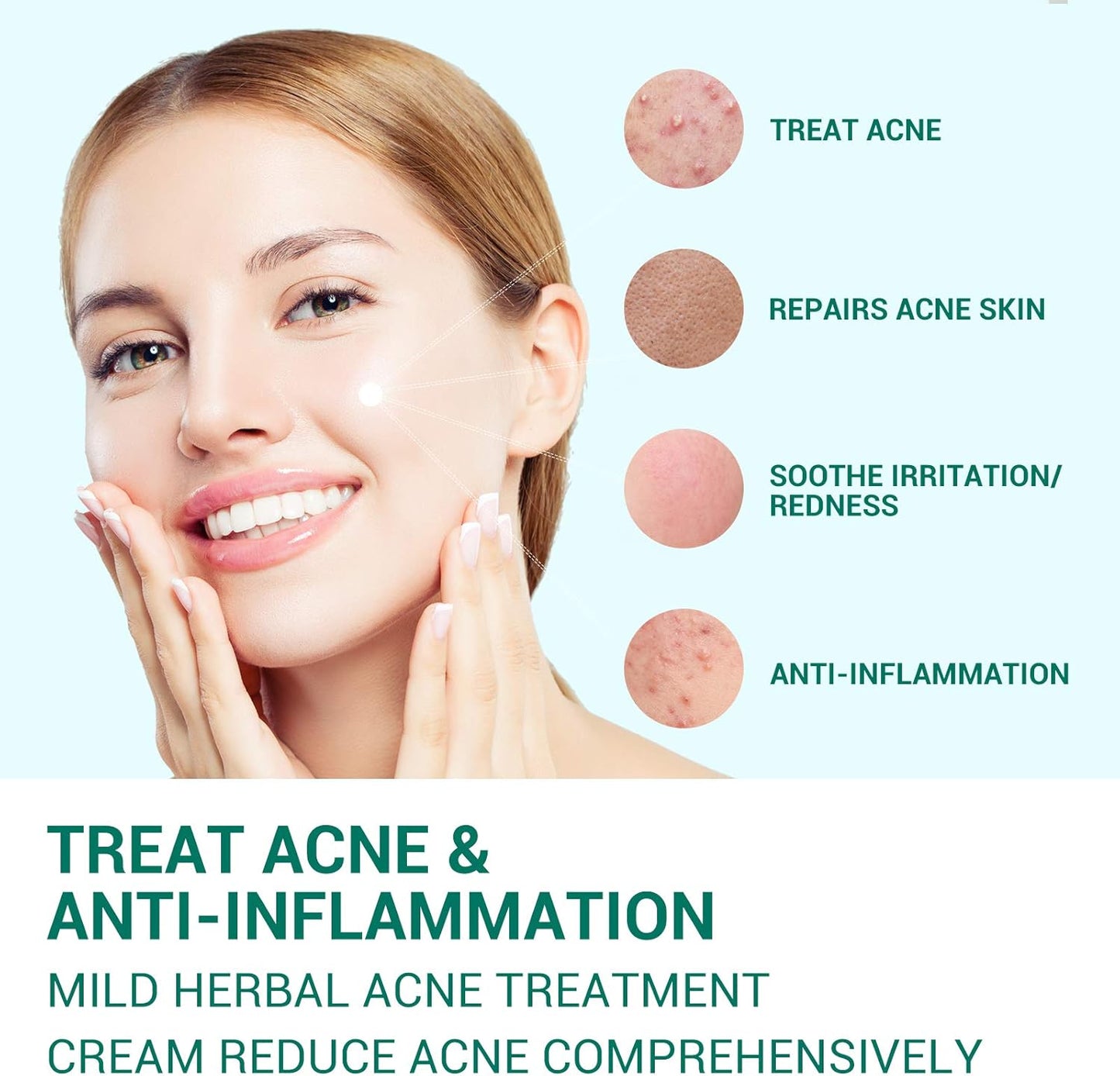 Lanbena Acne Treatment Gel – Clear, Calm & Restore