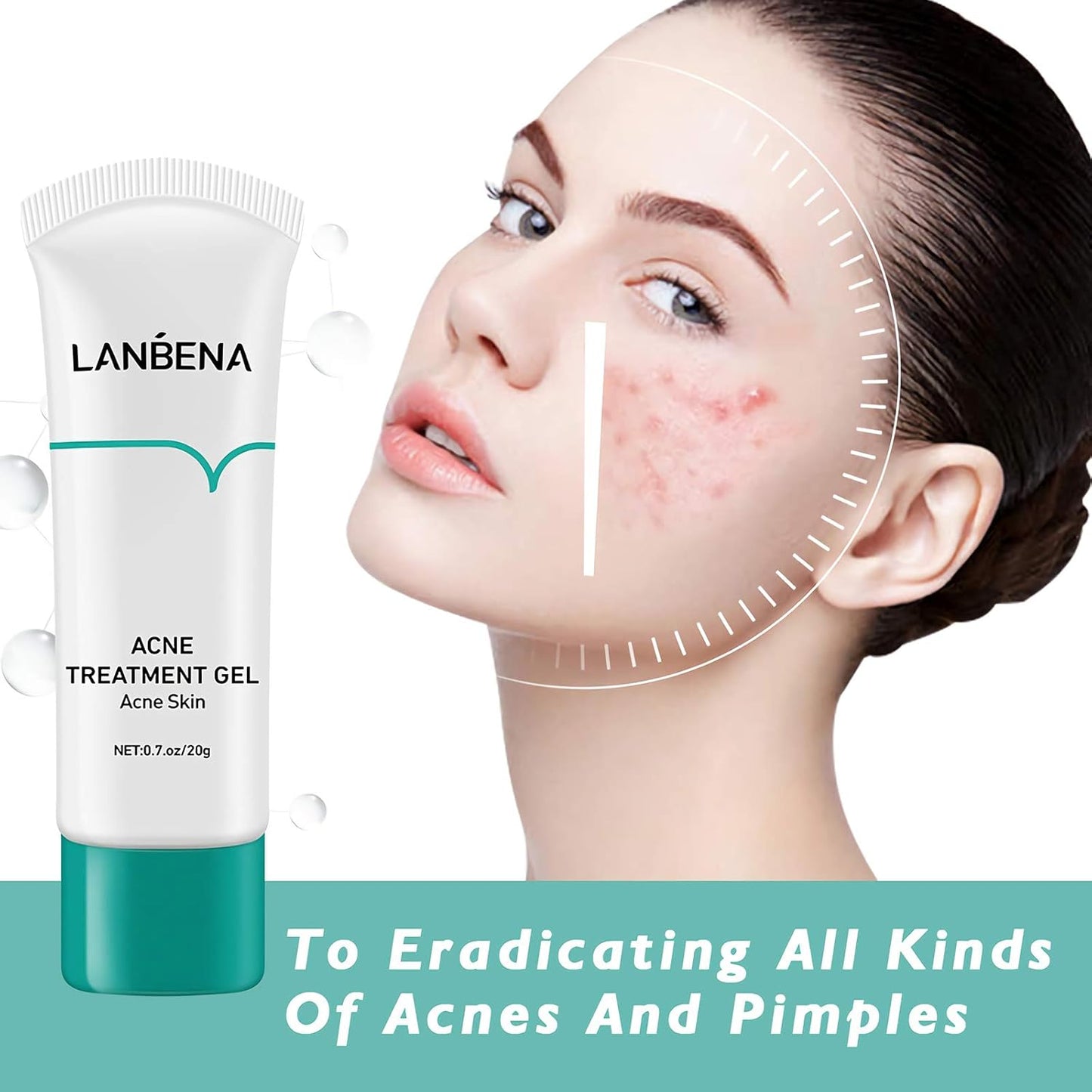 Lanbena Acne Treatment Gel – Clear, Calm & Restore