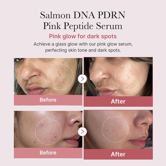 Medicube PDRN Pink Peptide Serum – Repair, Firmness & Radiance