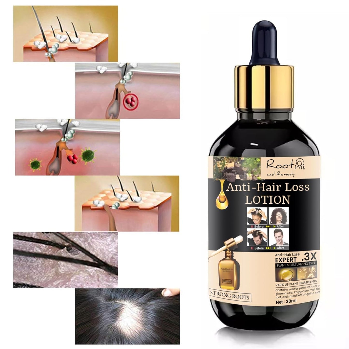 Anti-Hair Loss Lotion – Strong Roots Formula