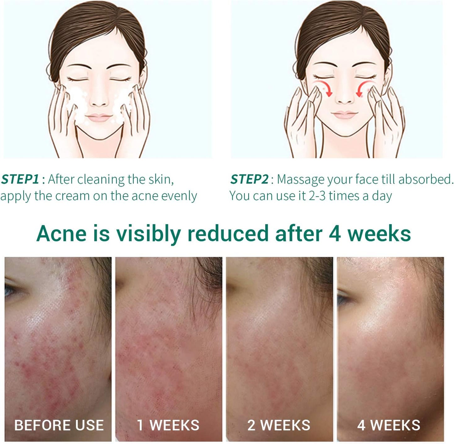 Lanbena Acne Treatment Gel – Clear, Calm & Restore
