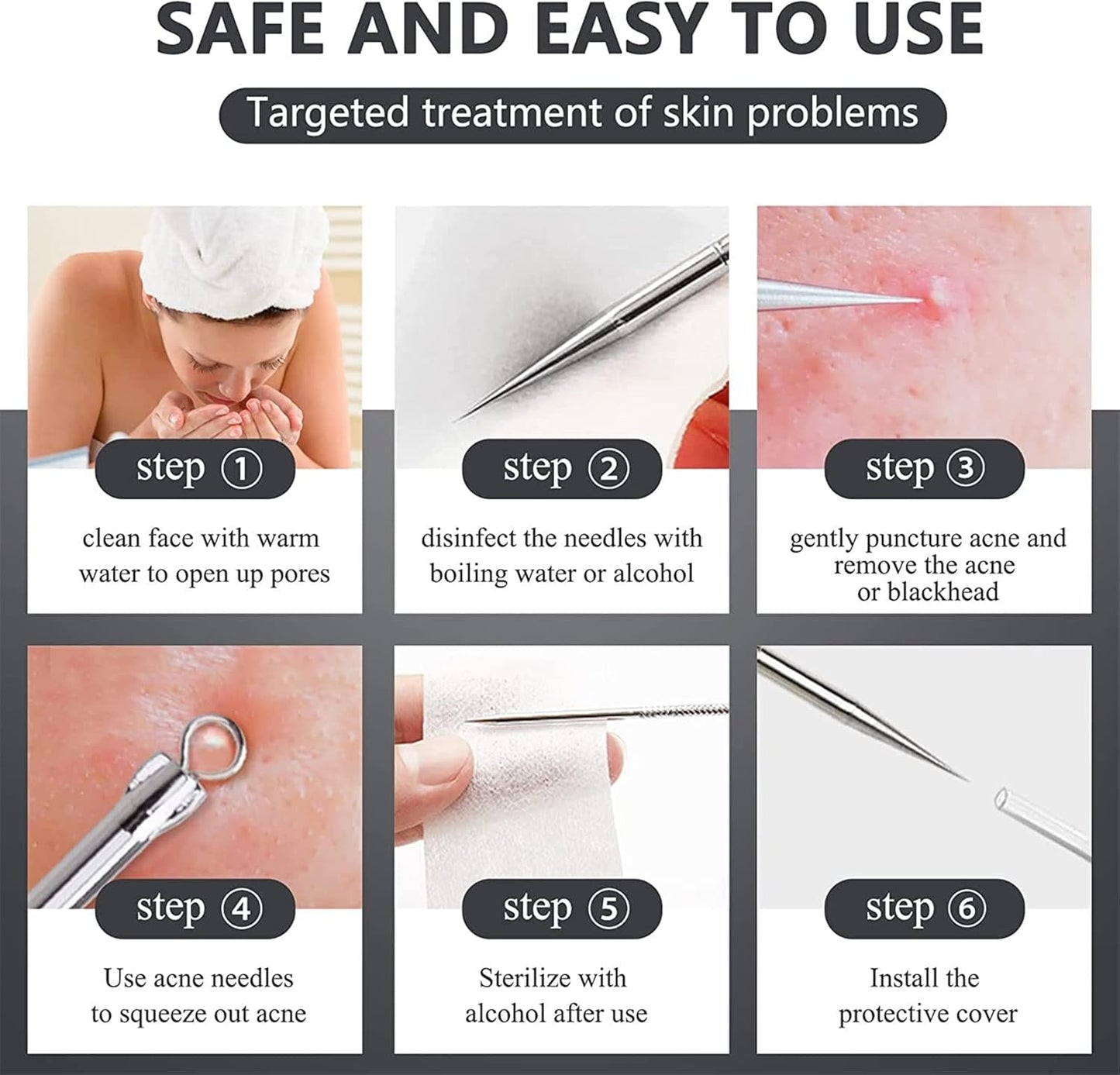 Blackhead Removal Kit – 4-in-1 Stainless Steel Extractor Set