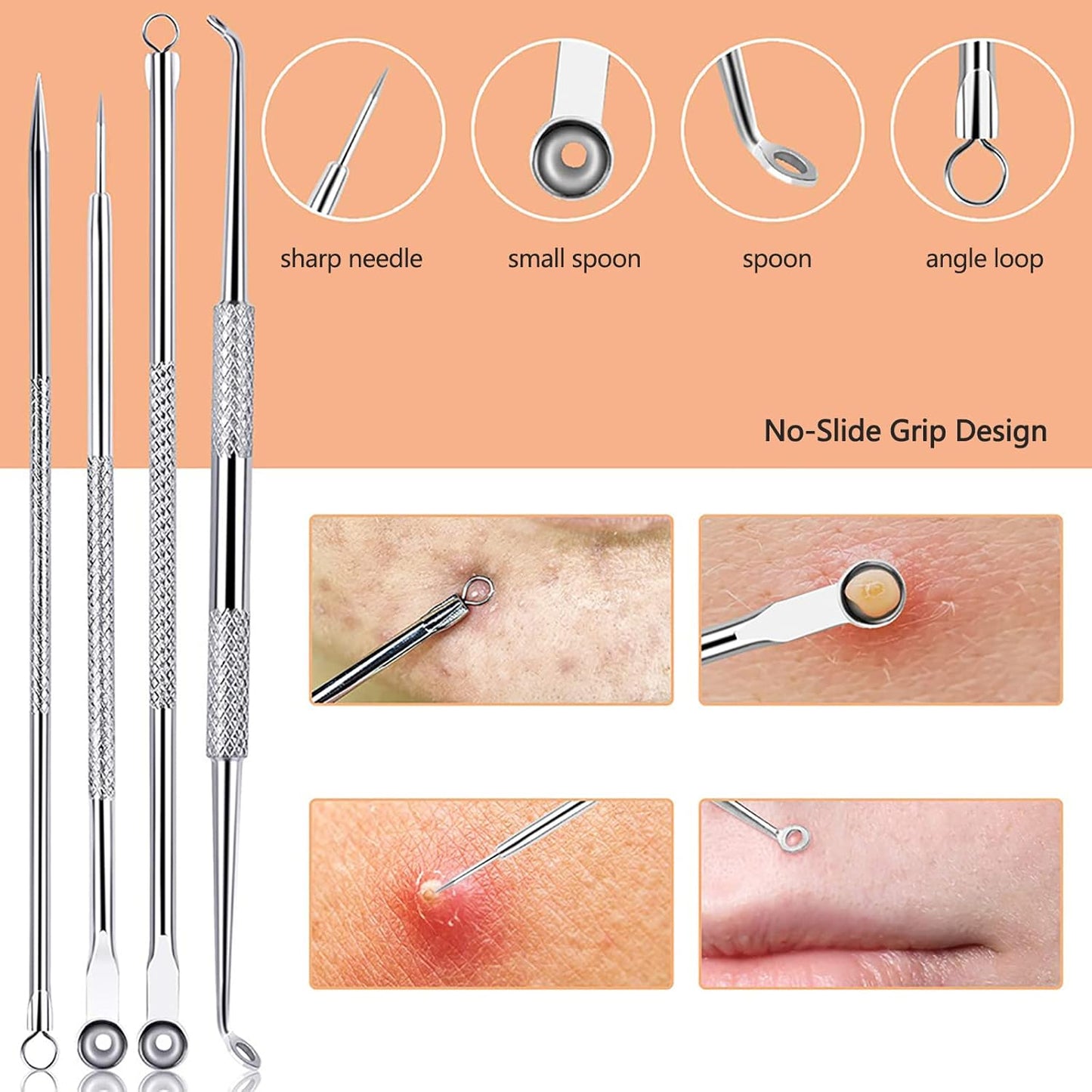 Blackhead Removal Kit – 4-in-1 Stainless Steel Extractor Set
