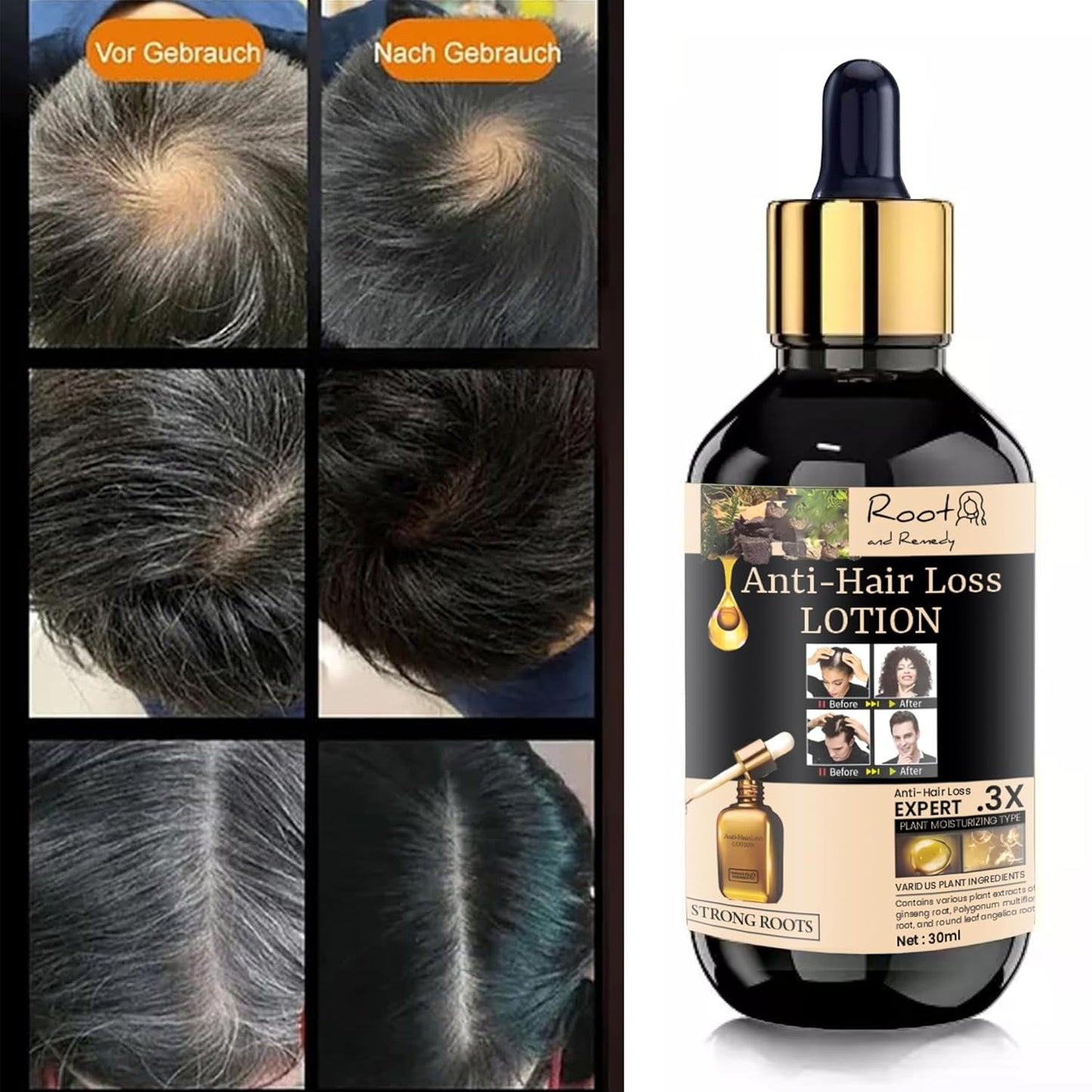 Anti-Hair Loss Lotion – Strong Roots Formula