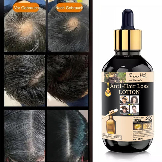 Anti-Hair Loss Lotion – Strong Roots Formula