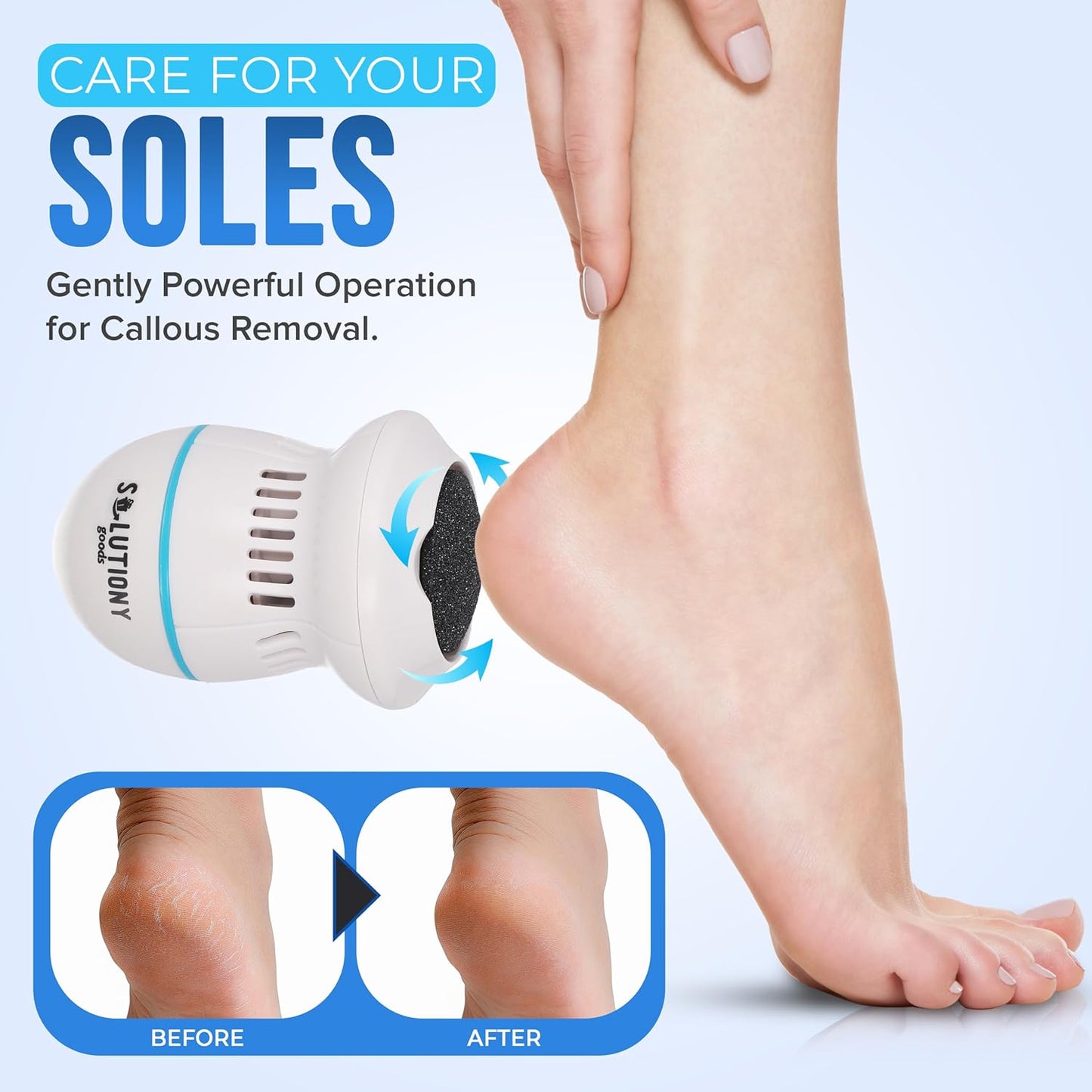 Electric Foot Callus Remover