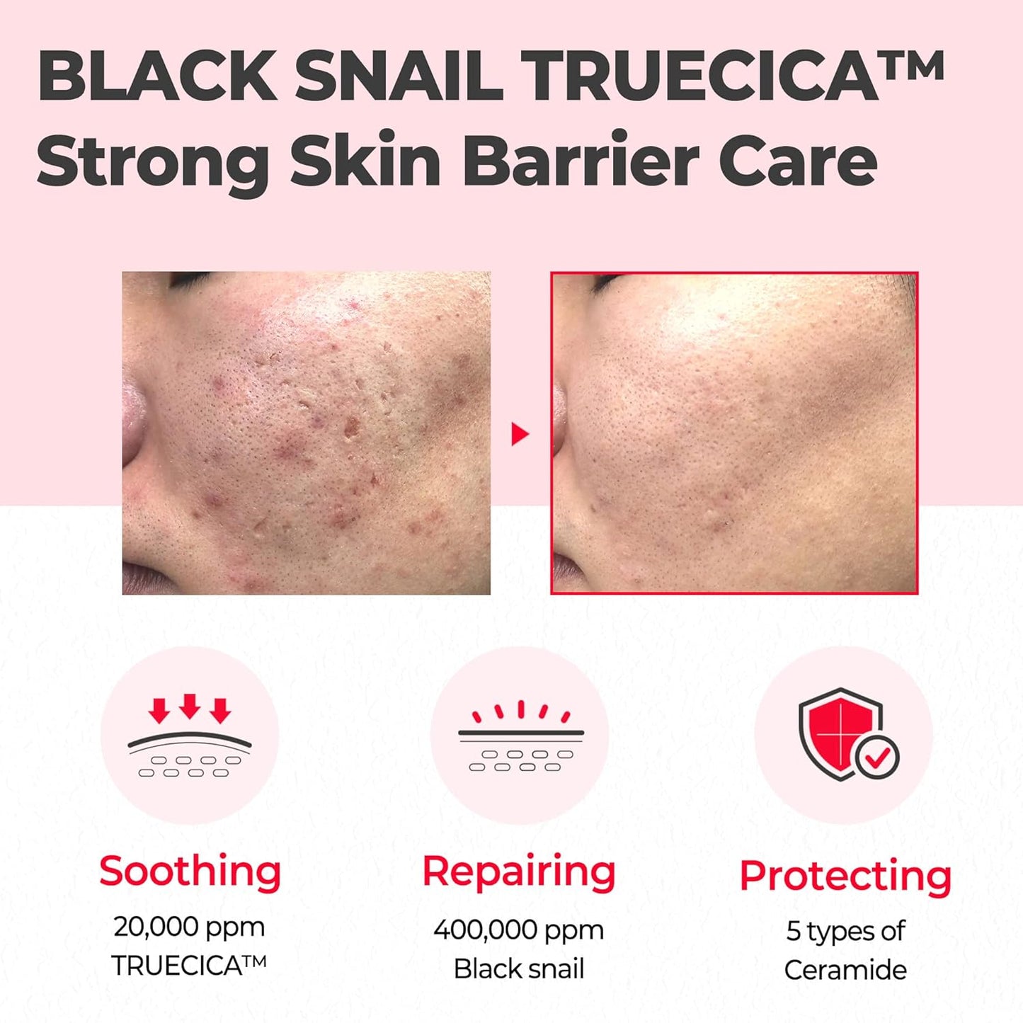 SOME BY MI Snail Truecica Miracle Repair Cream