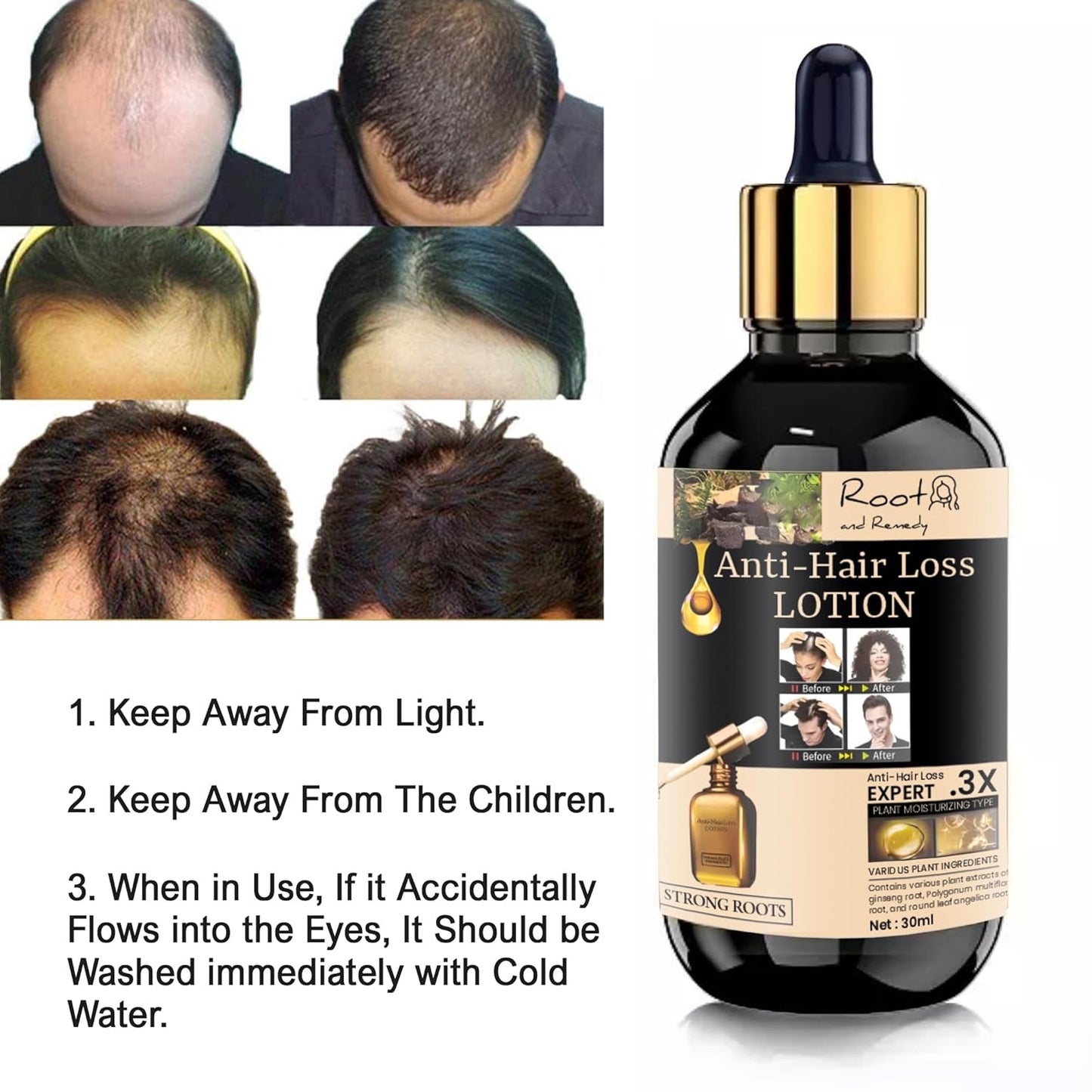 Anti-Hair Loss Lotion – Strong Roots Formula