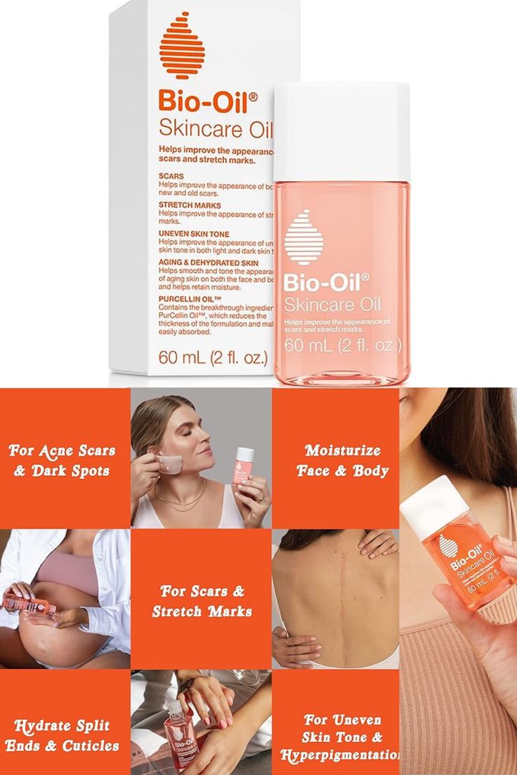 Bio-Oil Skincare Oil – Stretch Marks (60 ml)