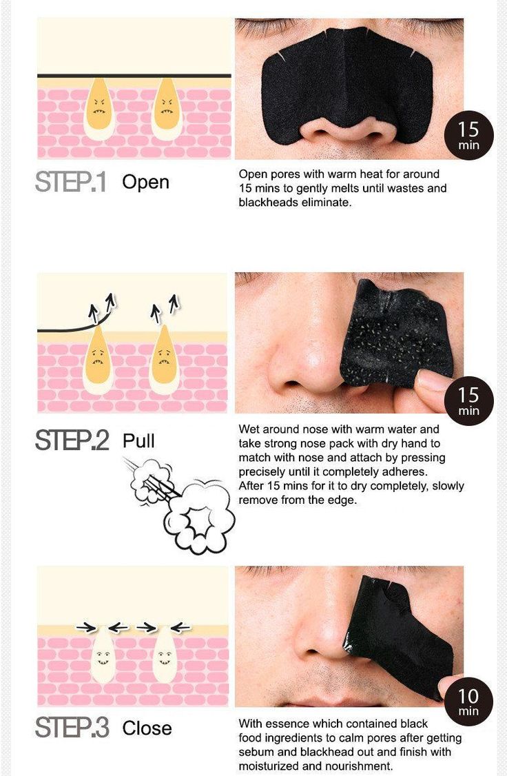 Dear She Olive Nose Pore Strips – 10 Strips