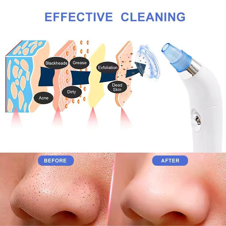 DermaSuction Pore Cleaning Device