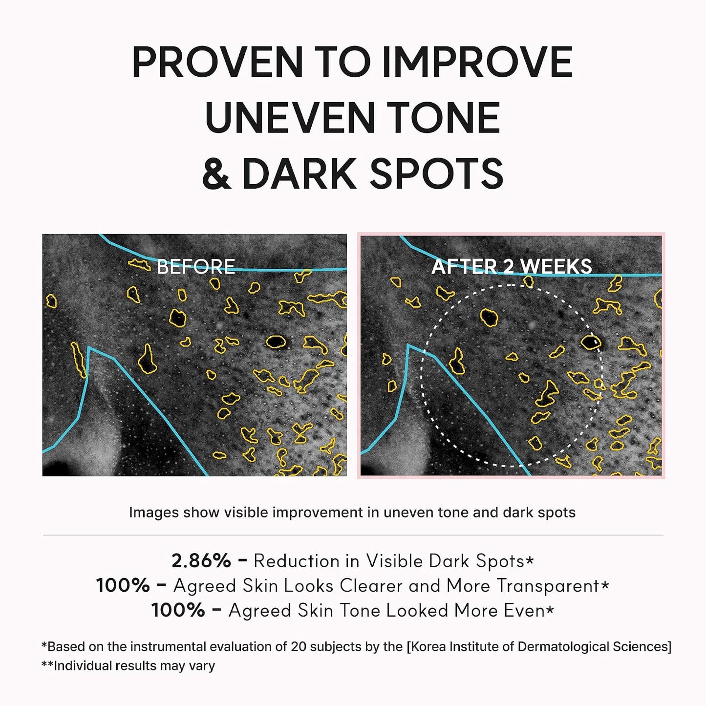 Arencia TXA Booster Shot