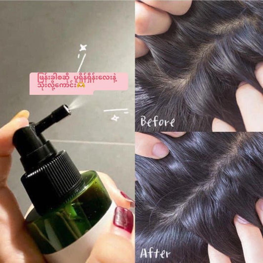 SOME BY MI Cica Peptide Anti Hair Loss Derma Scalp Tonic