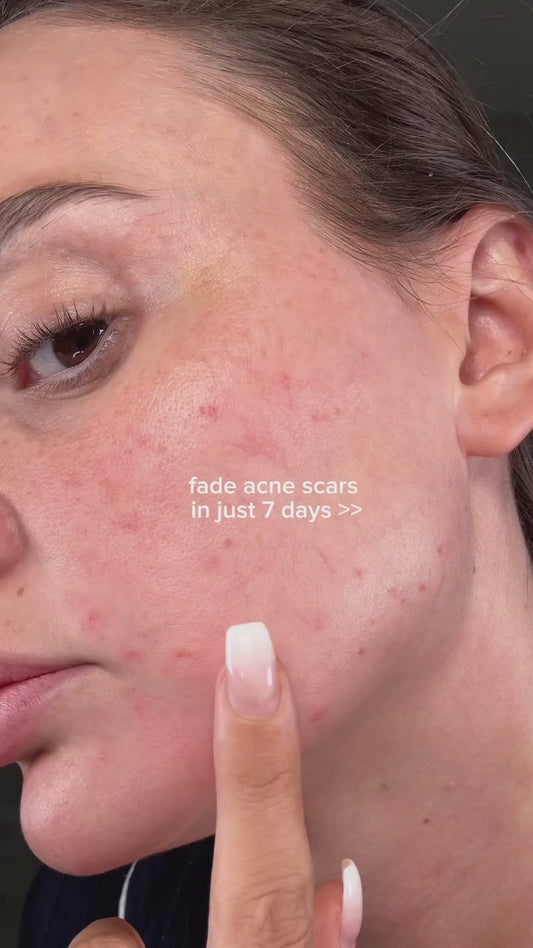 Dr. Althea 345 Relief Cream